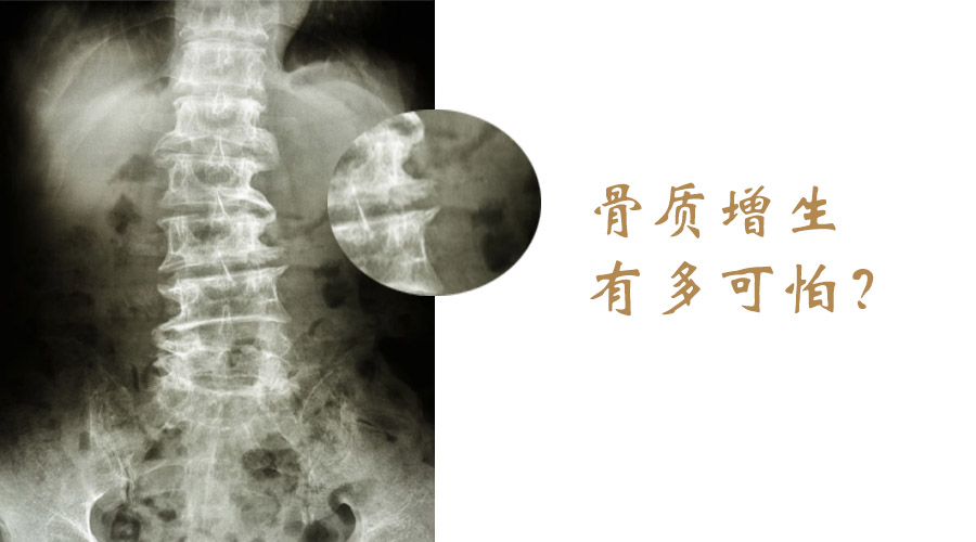 骨质增生如何防治?