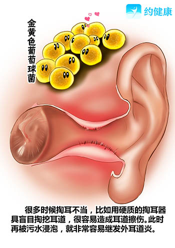 游泳和耳病9.jpg