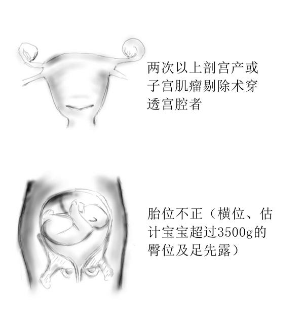 刨宫产(1)_09.jpg