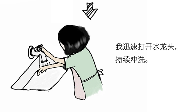 烫伤_05.jpg 烫伤_05.jpg