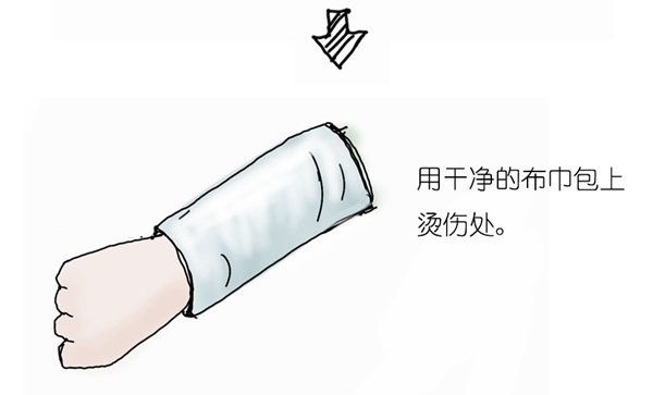 烫伤_14.jpg 烫伤_14.jpg