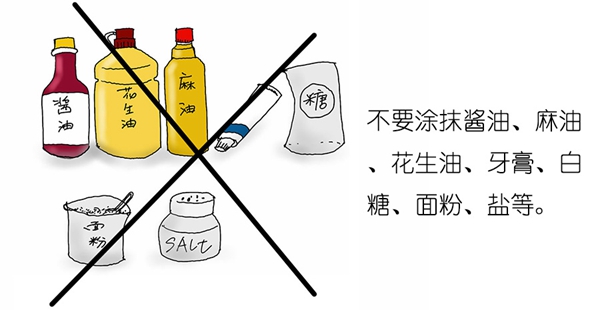 烫伤_22.jpg 烫伤_22.jpg