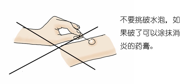 烫伤_19.jpg 烫伤_19.jpg