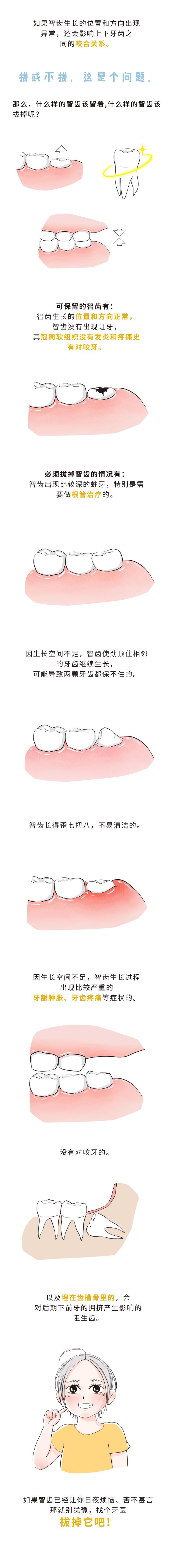 许俊君，智齿拔还是不拔？这是个问题...(2).jpg