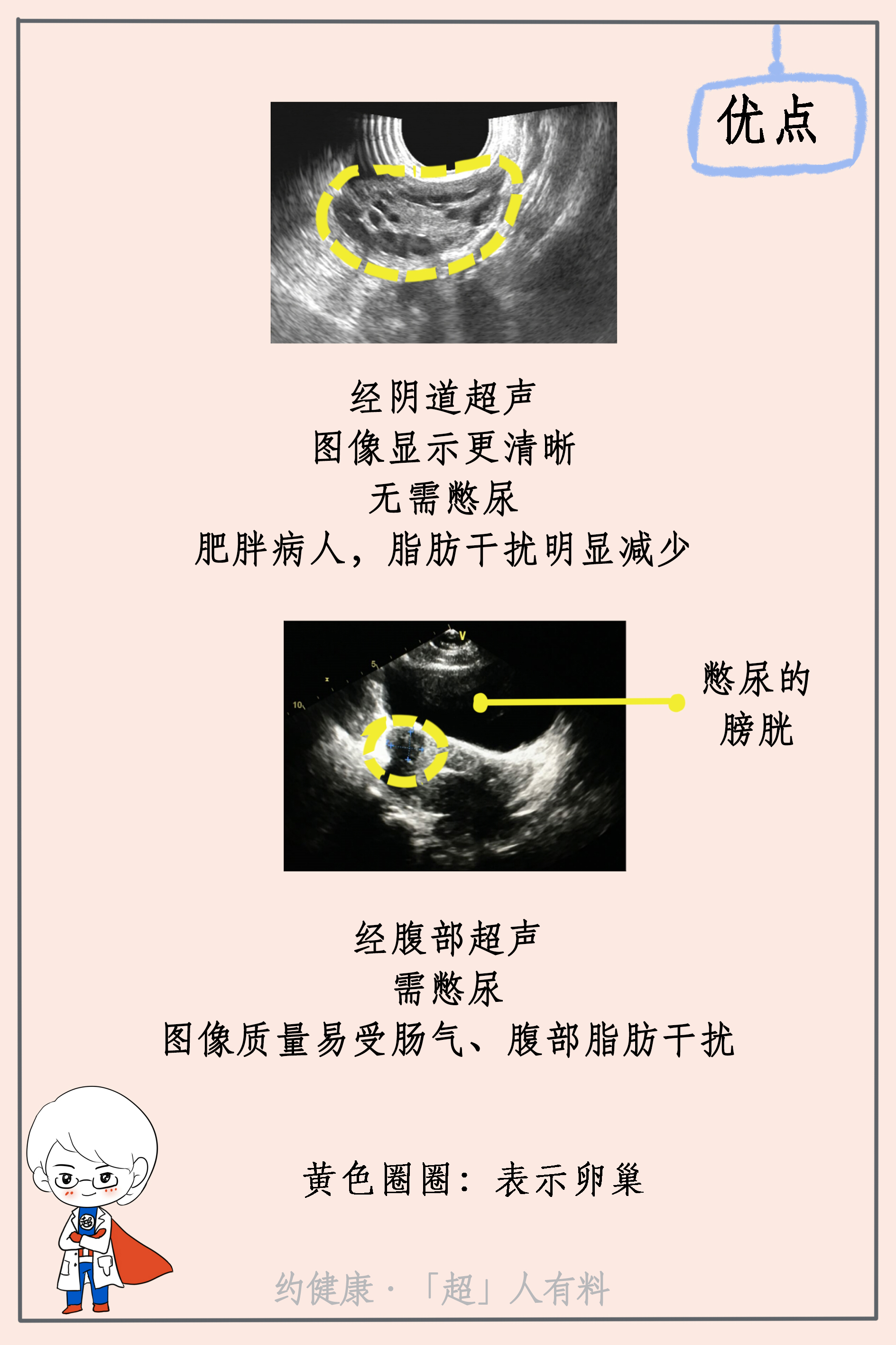 妇科超声检查8.jpg