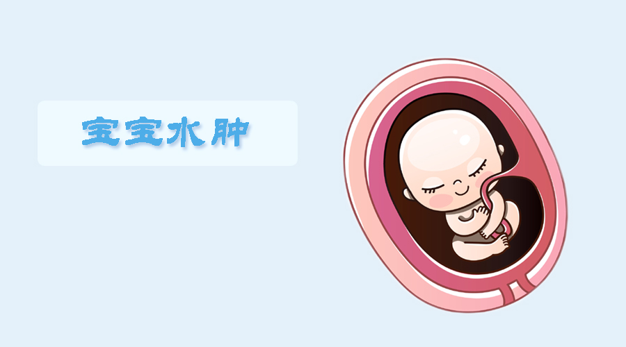 胎儿水肿,还可以生吗?